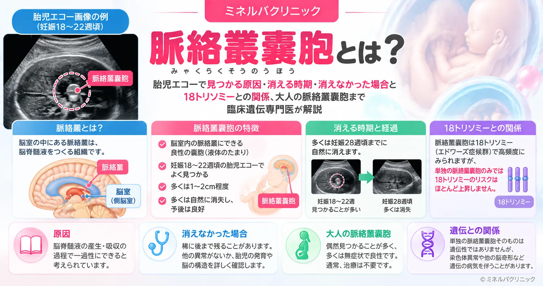 脈絡叢嚢胞(みゃくらくそうのうほう)とは 脈絡叢嚢胞とは何か、胎児エコーで見つかったときに単独の場合とほかの所見がある場合で意味が違うことを示したインフォグラフィック