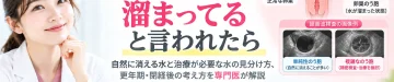 卵巣に水が溜まっていると言われた場合に、自然に消えることがある嚢胞と治療が必要なケース、更年期・閉経後の考え方を解説するアイキャッチ