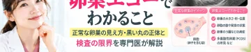 卵巣エコーで確認できる卵巣の大きさや卵胞、正常な見え方、黒い丸の正体と検査の限界を解説するアイキャッチ