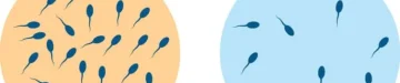 精子の量が少ない