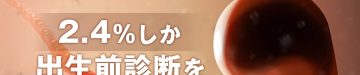 nipt-positive-20s-case_LP_0705