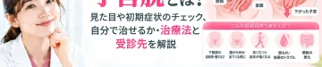 子宮脱について、見た目や初期症状のセルフチェック、自分でできる対策、治療法と受診先を解説するアイキャッチ