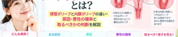 子宮ポリープについて、頸管ポリープと子宮内膜ポリープの違い、原因や悪性の可能性、切除するかの判断を解説するアイキャッチ