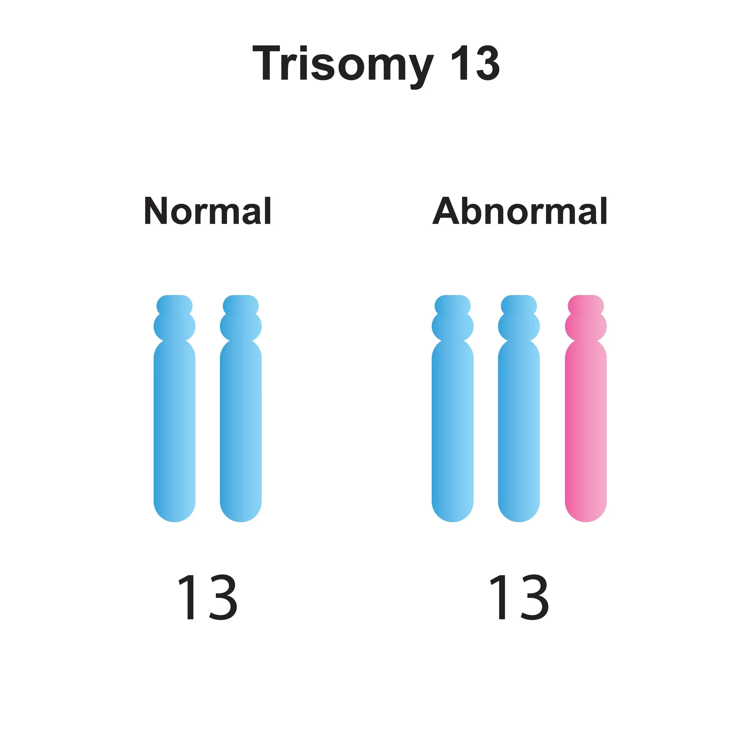 13トリソミー（パトウ症候群）のデザイン